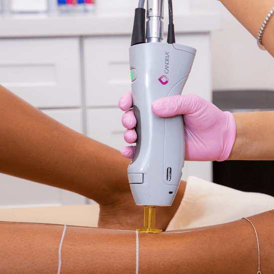 Laser hair removal treatment at Paradise Laser Delray Beach
